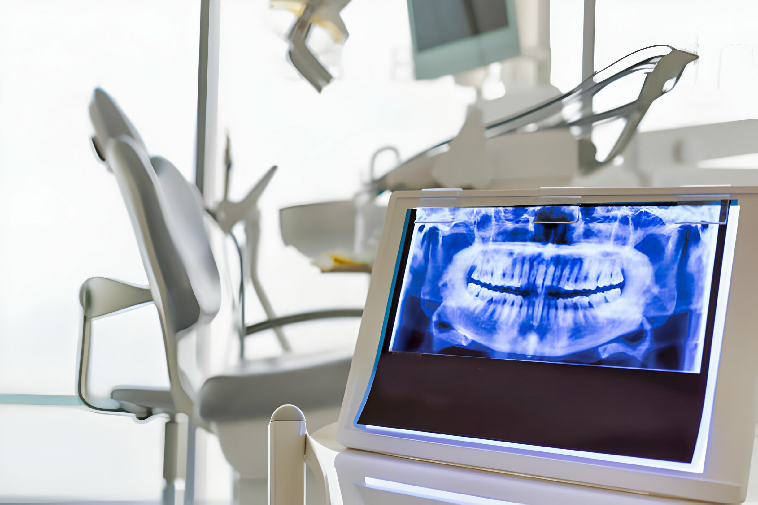 Digital Dental X Rays | Lakeshore Dental | Etobicoke 